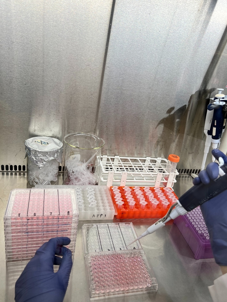 梁教授與香港兒童醫院團隊嘗試直接採用病人的骨髓癌細胞測試藥物效果,研發「精準化個人治療」,在實驗室內作體外測試癌細胞對45種標靶藥物的反應,並於3天後將報告交給醫生,由他們決定治療方案。