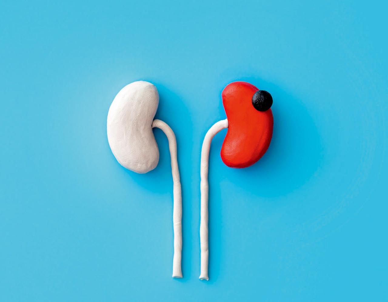 免疫+標靶 對抗晚期腎癌