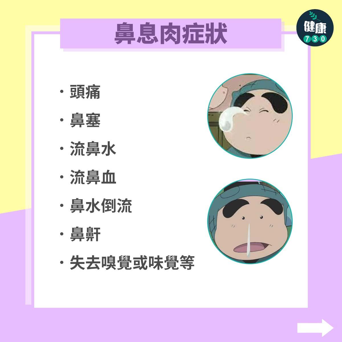 鼻敏感可致鼻息肉,鼻息肉症狀包括頭痛、鼻水倒流及鼻鼾等。(am730製圖)