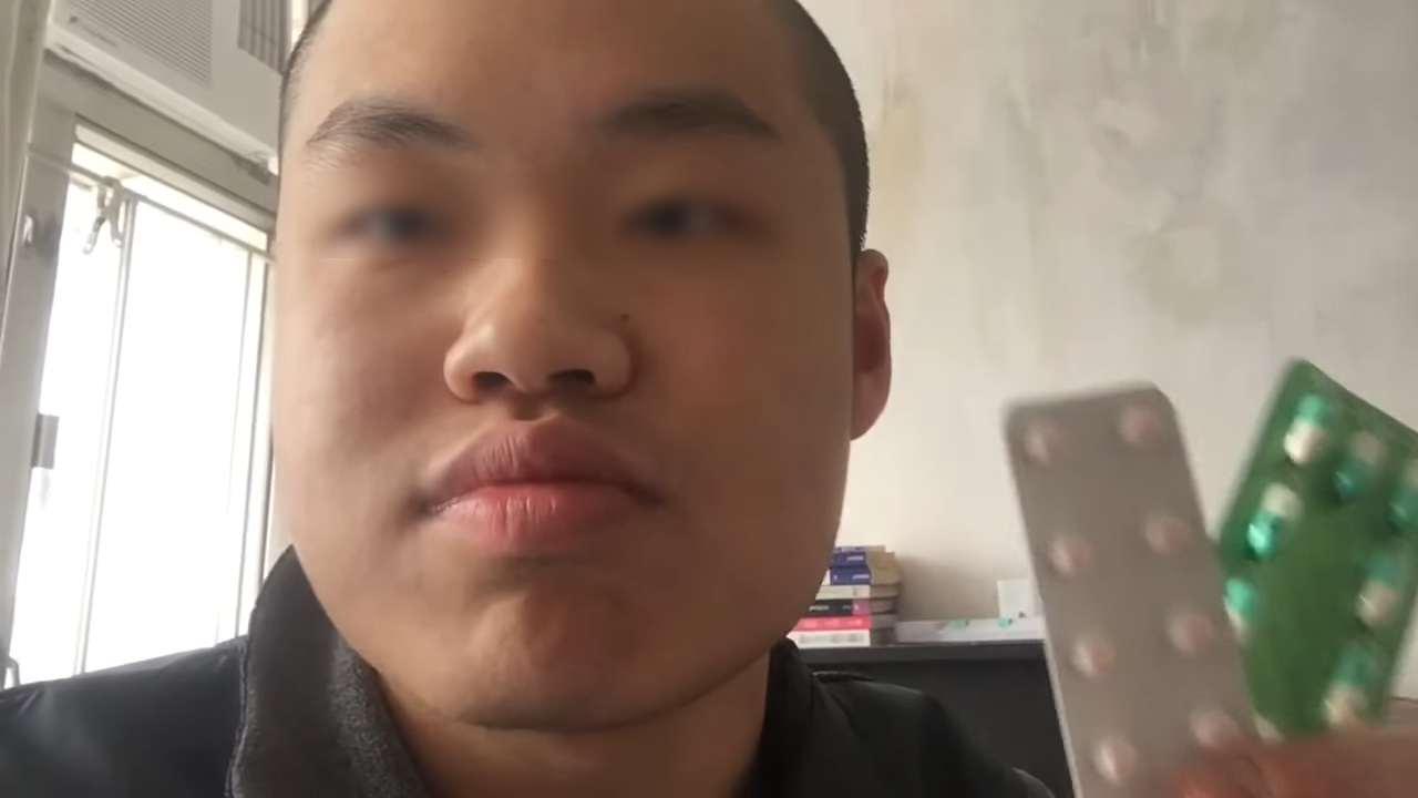 光頭Bob曾拿住藥物,並在鏡頭前服食大量藥物。