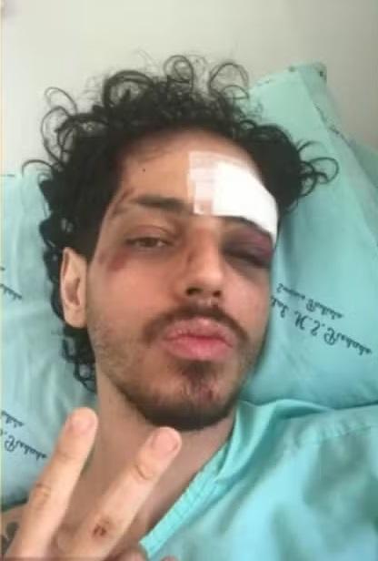 特謝拉手術後留醫,向傳媒展示V字手勢。(互聯網)