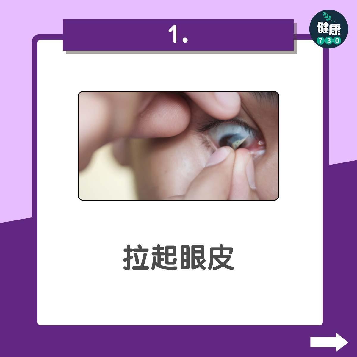 隱形眼鏡|除唔到con?3步驟幫你改善除con技巧不傷眼(am730製圖)