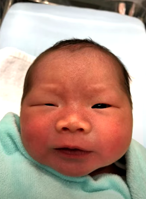 小雪兒的媽媽Amy在無綫節目《東張西望》中受訪表示,女兒獲院方安排接受重置頭骨手術。(《東張西望》畫面)