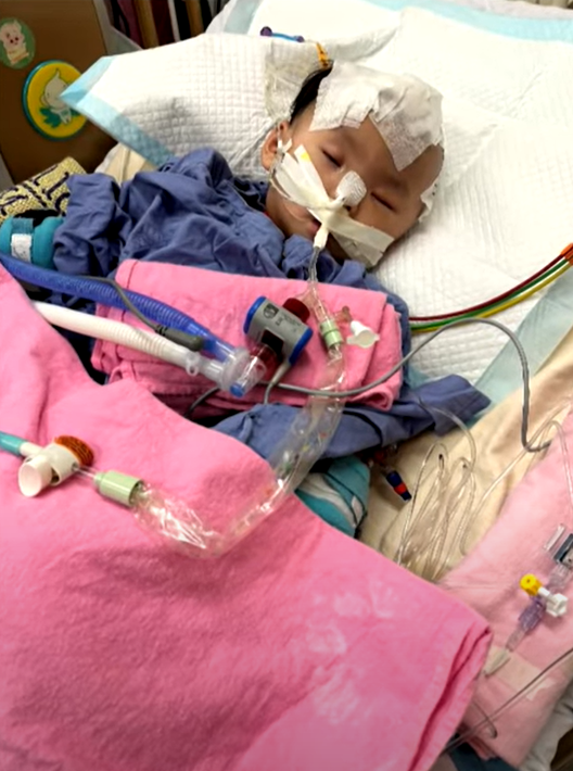 小雪兒的媽媽Amy在無綫節目《東張西望》中受訪表示,女兒獲院方安排接受重置頭骨手術。(《東張西望》畫面)