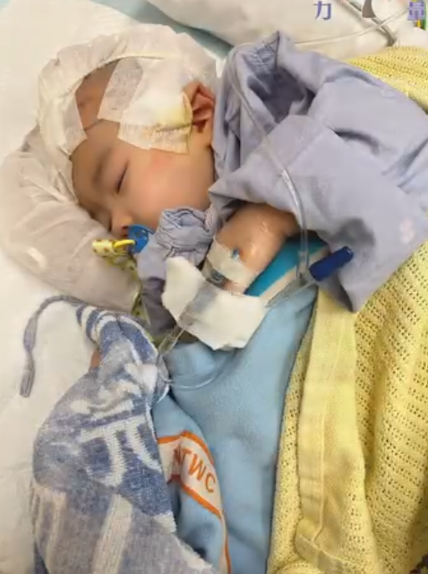 小雪兒於今年1月疑在社區保母照顧期間被虐待致後腦出血,導致腦部大面積萎縮壞死,她周一(3日)在屯門醫院完成頭骨重置手術。香港關懷力量圖片