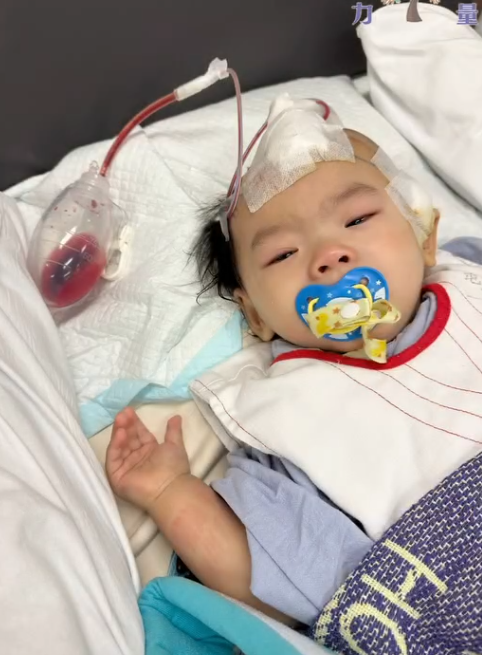 小雪兒於今年1月疑在社區保母照顧期間被虐待致後腦出血,導致腦部大面積萎縮壞死,她周一(3日)在屯門醫院完成頭骨重置手術。香港關懷力量圖片