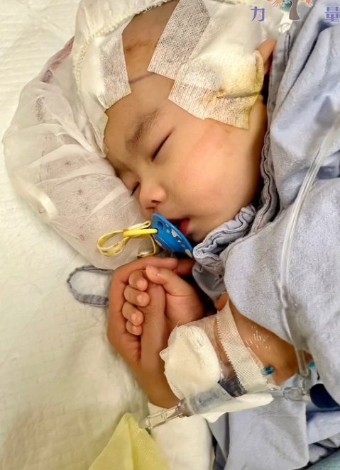 小雪兒於今年1月疑在社區保母照顧期間被虐待致後腦出血,導致腦部大面積萎縮壞死,她周一(3日)在屯門醫院完成頭骨重置手術。香港關懷力量圖片