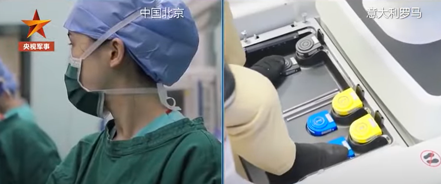 一名前列腺癌病人在北京接受手術,但醫生卻身在8,100公里外的意大利羅馬遙距操刀。(影片截圖)