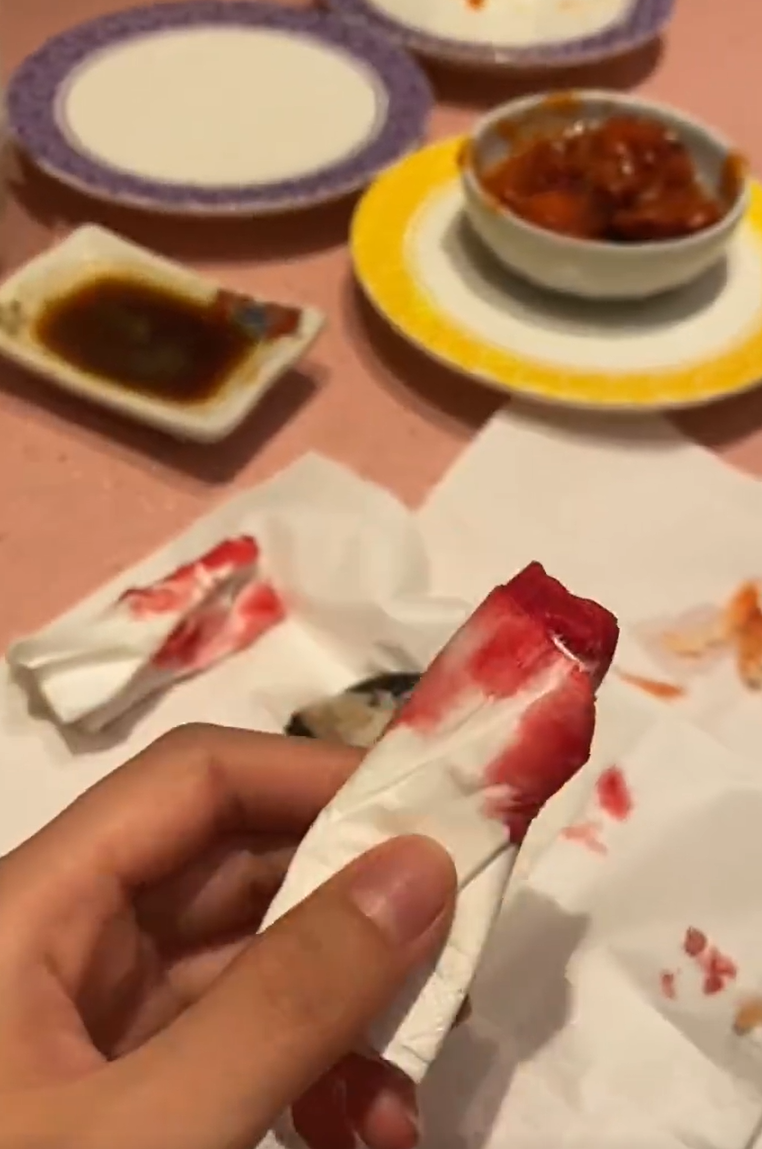 廣東中山一名女子光顧當地一間日式料理店,吃壽司時咬到異物,導致口腔被刮傷流血,店方及後賠償一千元人民幣達成和解。(影片截圖)