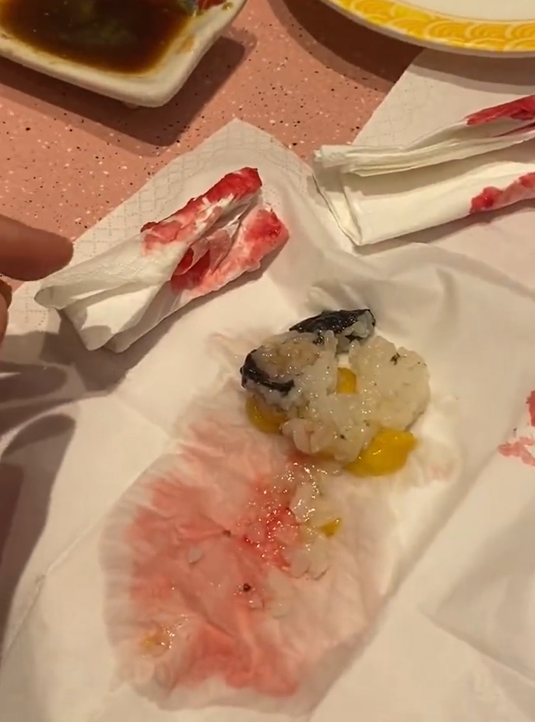 廣東中山一名女子光顧當地一間日式料理店,吃壽司時咬到異物,導致口腔被刮傷流血,店方及後賠償一千元人民幣達成和解。(影片截圖)