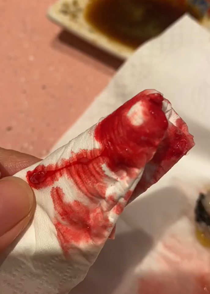 廣東中山一名女子光顧當地一間日式料理店,吃壽司時咬到異物,導致口腔被刮傷流血,店方及後賠償一千元人民幣達成和解。(影片截圖)