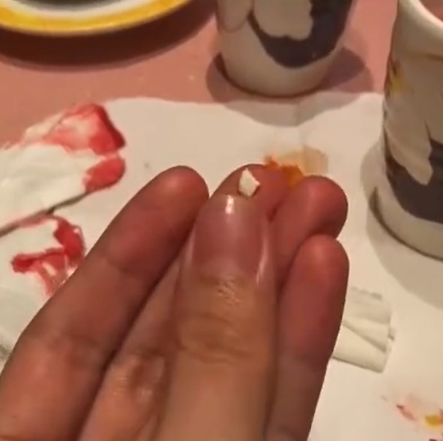 廣東中山一名女子光顧當地一間日式料理店,吃壽司時咬到異物,導致口腔被刮傷流血,店方及後賠償一千元人民幣達成和解。(影片截圖)