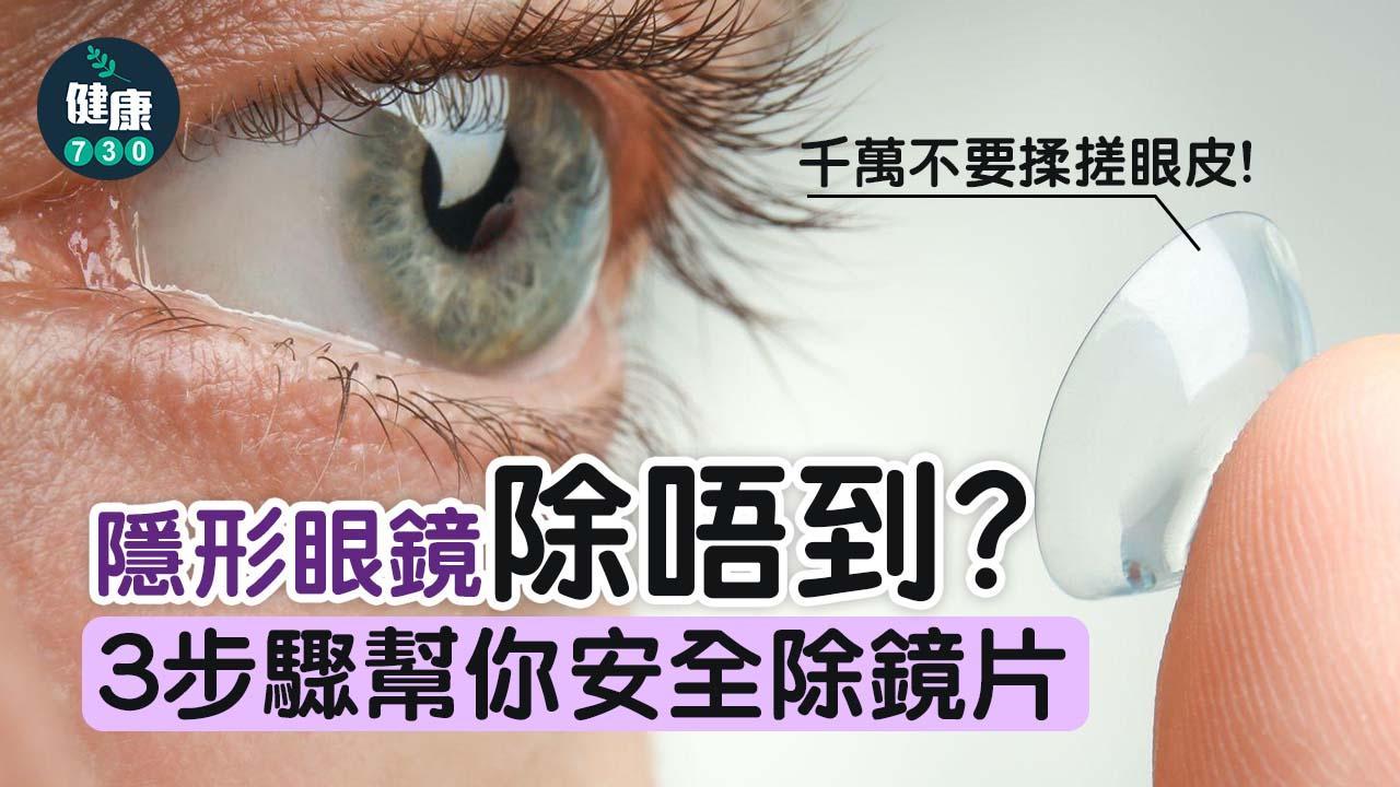 隱形眼鏡|除唔到con?3步驟幫你改善除con技巧不傷眼(am730製圖)