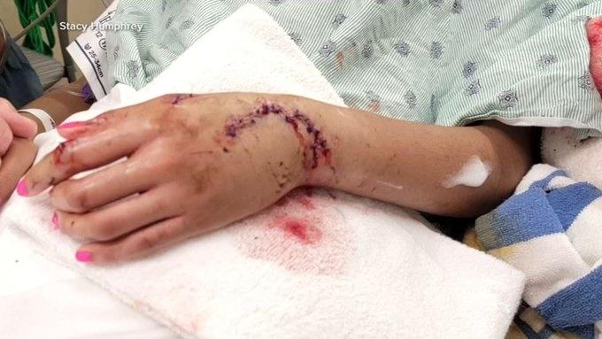 其中一名傷者傷勢。(X)