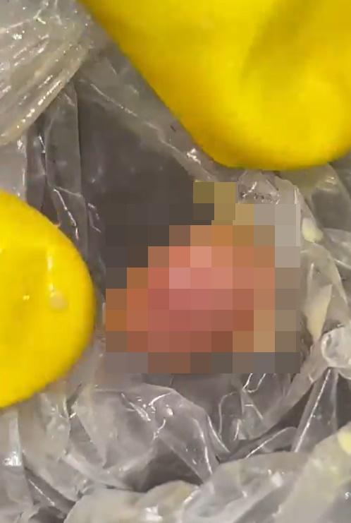 Serrao說:「我是一名醫生,熟悉人體各部位的樣子,它有指甲和指紋,應該是人類的拇指。」(X)