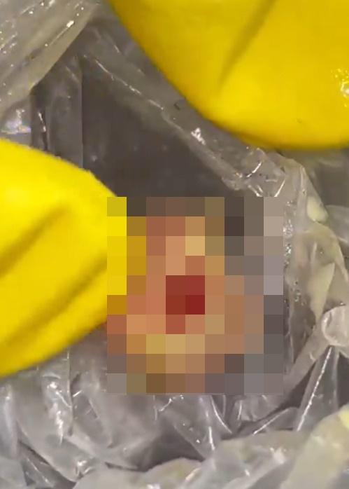 Serrao說:「我是一名醫生,熟悉人體各部位的樣子,它有指甲和指紋,應該是人類的拇指。」(X)