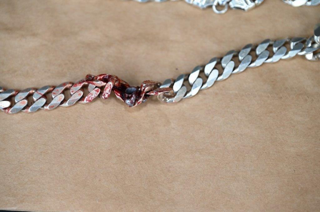 警方在社交平台Facebook分享了血跡斑斑的項鏈照片,清楚可見頸鏈確實卡著了子彈。(FB)