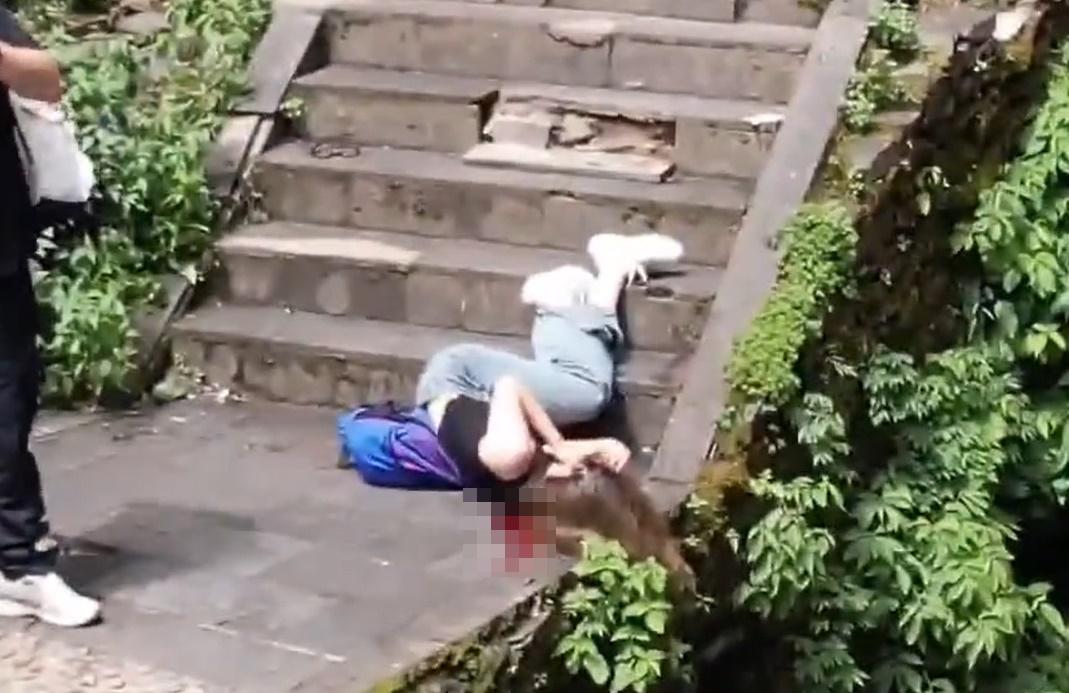 受傷女子起初還有輕微動作,其後再沒反應。(微博)