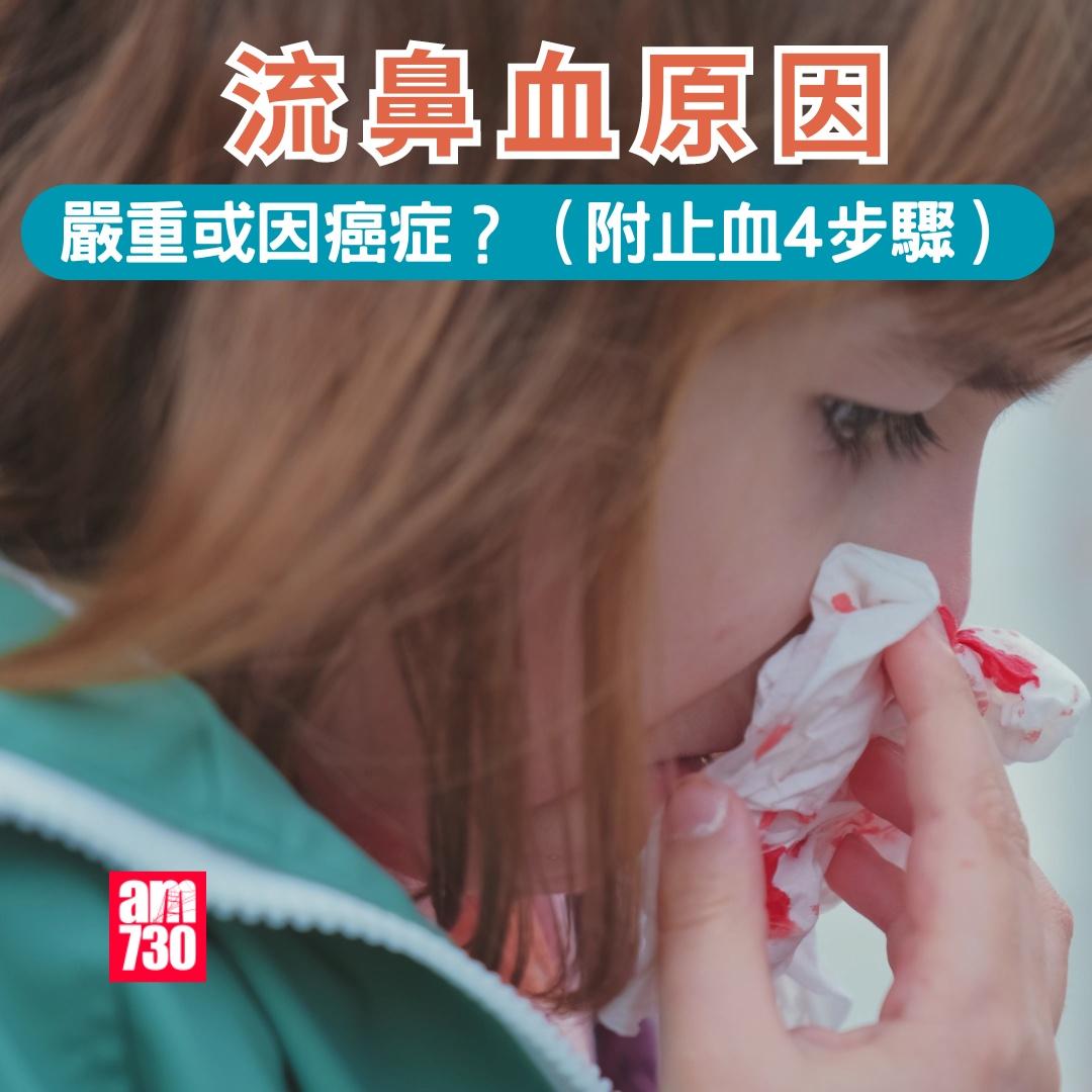 流鼻血原因及處理方法,嚴重或因癌症?(am730製圖)