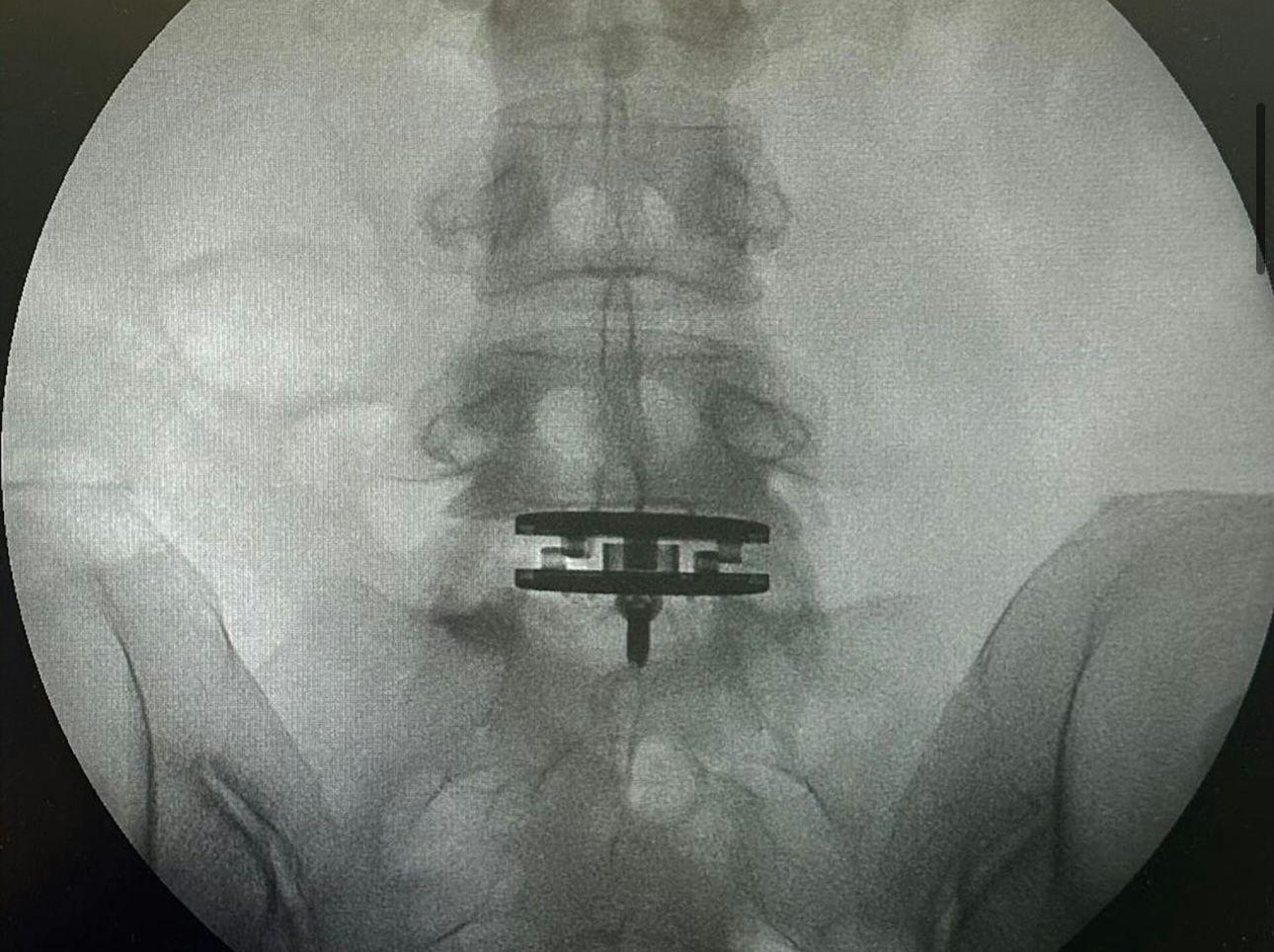 徐濠縈在IG上載了數張X光片。