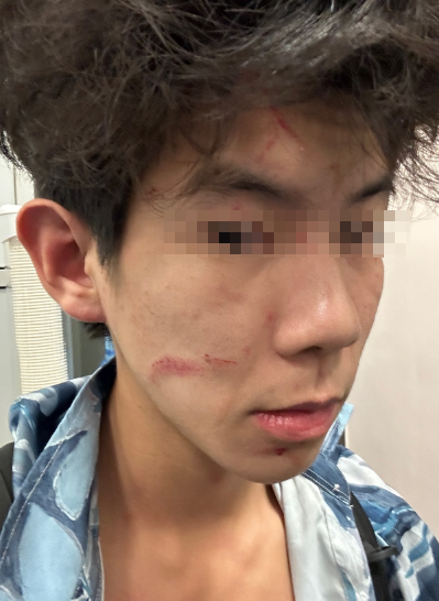 疑似被打的男士臉上有數處傷痕。(IG@_see_mi_2)