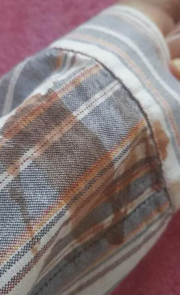 一名16歲中國留學生上周在新西蘭奧克蘭的巴士上,遭人用金屬棍襲擊,面部嚴重損傷。(網上圖片)