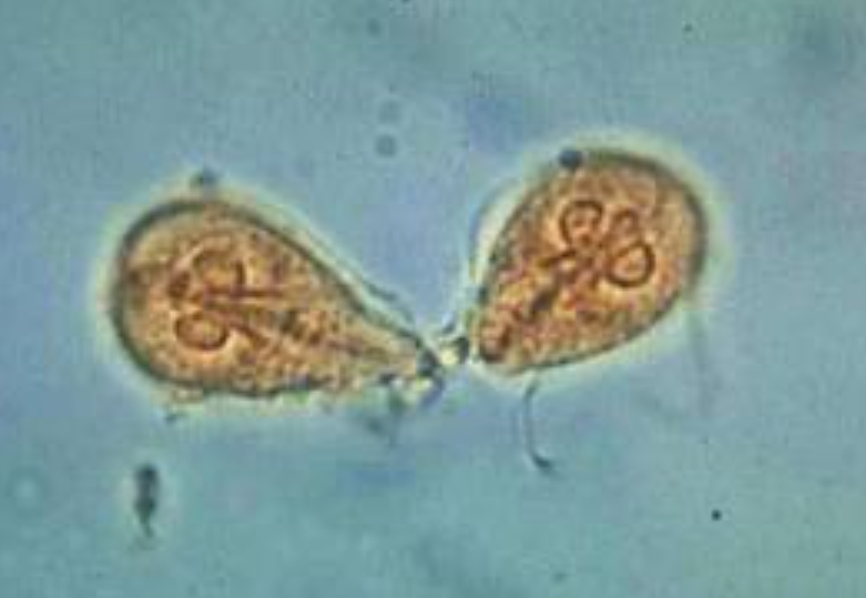 顯微鏡下的藍氏賈第鞭毛蟲。(互聯網)