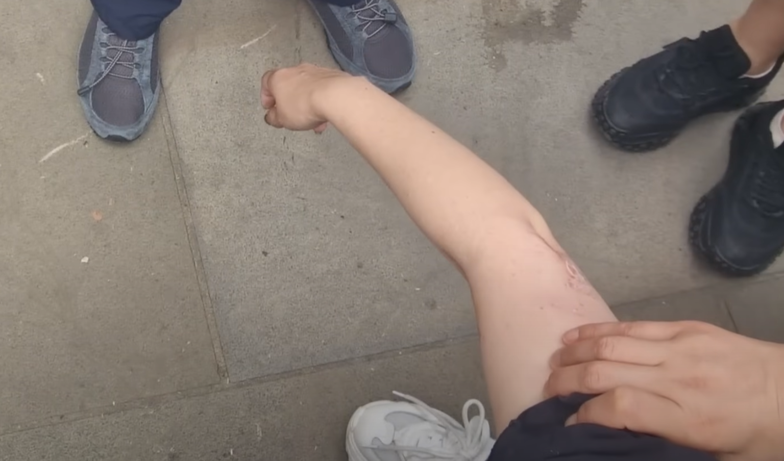 該名女遊客蹲在地上單手撐地,更在友人為其處理傷口時暈倒。(影片截圖)