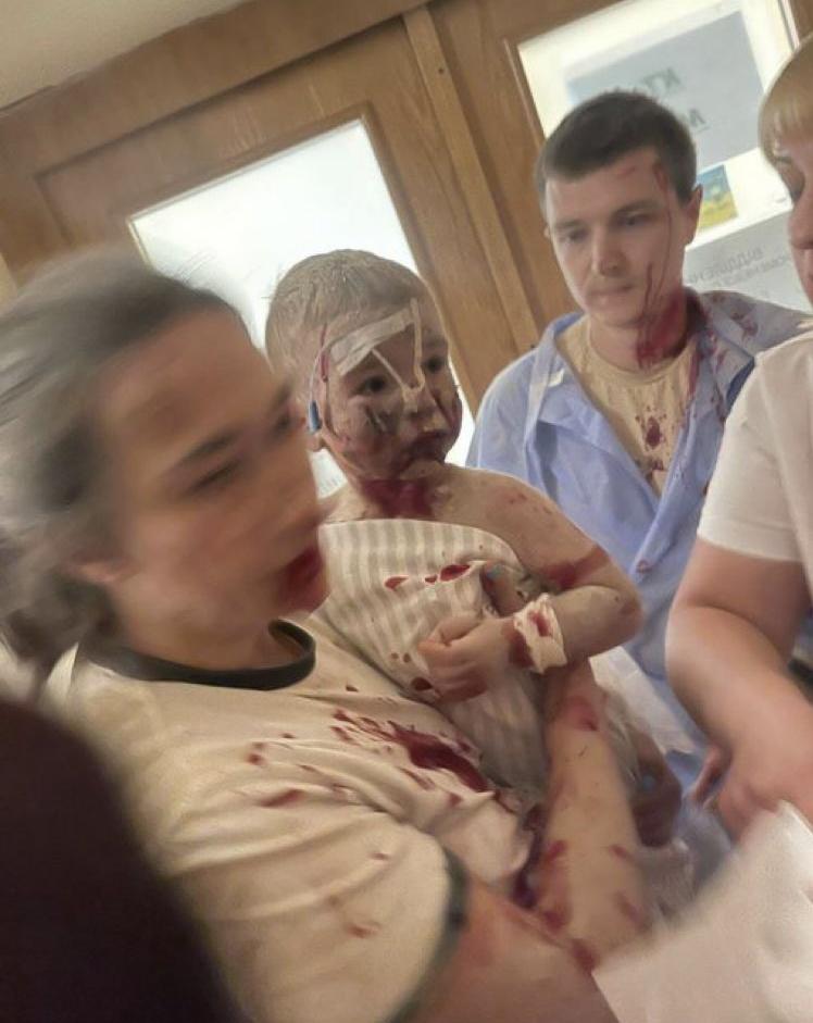 兒童醫院主樓建築嚴重受損,部份倒塌,冒出大量濃煙,多人被埋。(X)