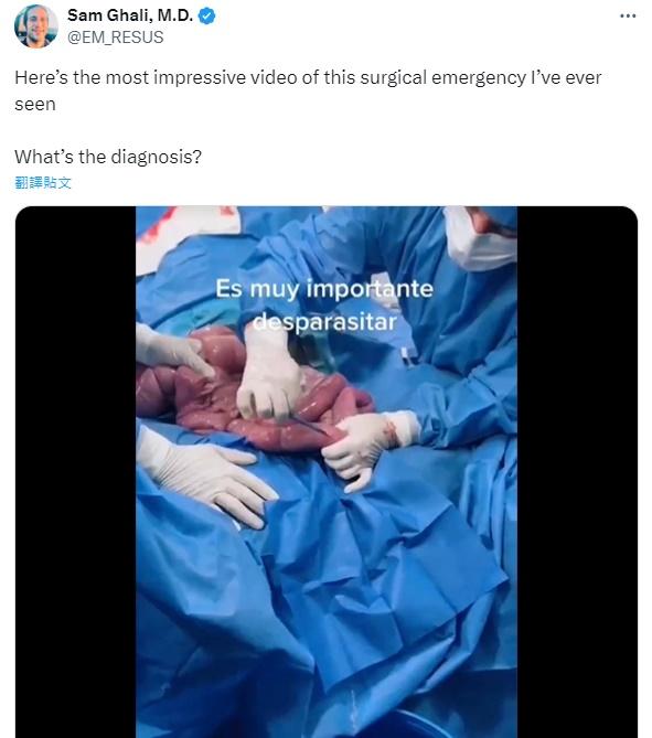 美國醫生Sam Ghali都驚嘆表示一見難忘。(X)