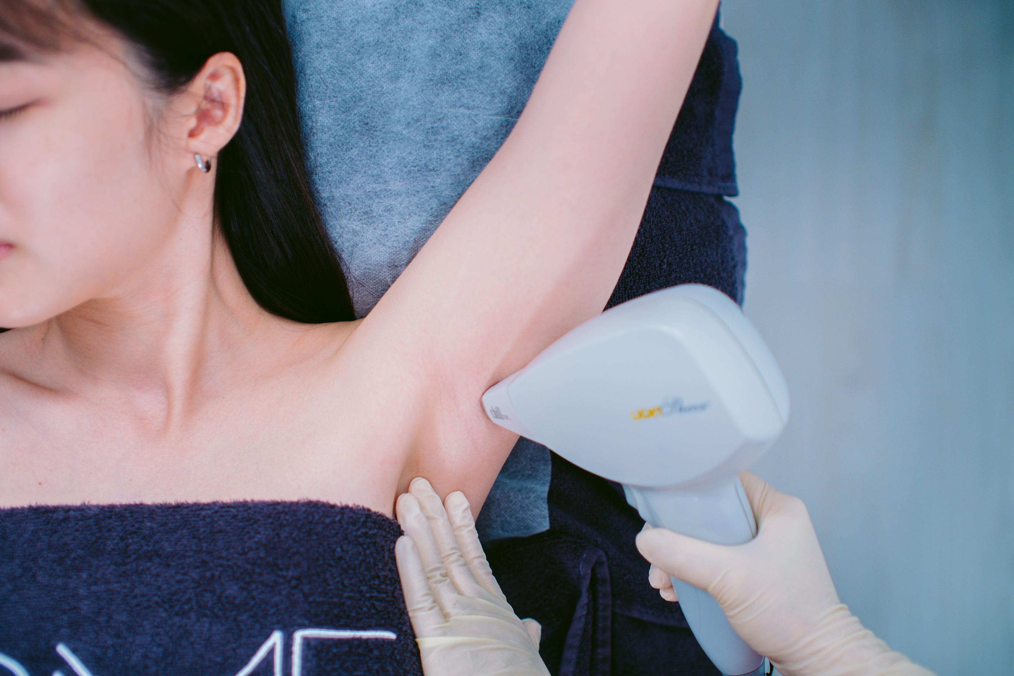 BMF的王牌「激光脫毛療程」採用為東方亞洲人膚色而設的儀器