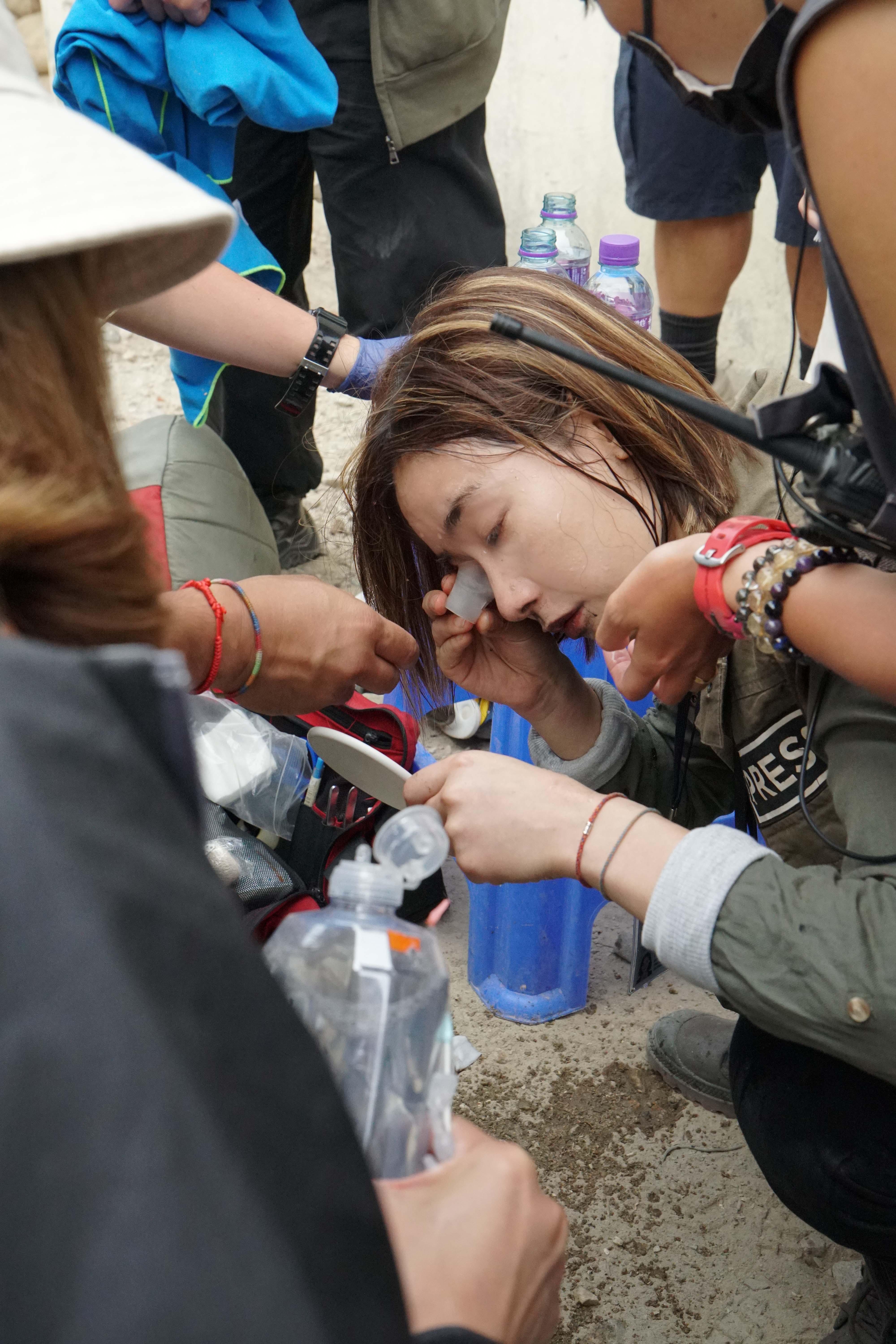 劉雅瑟拍爆破戲時,不慎被化學品弄致眼部受傷。