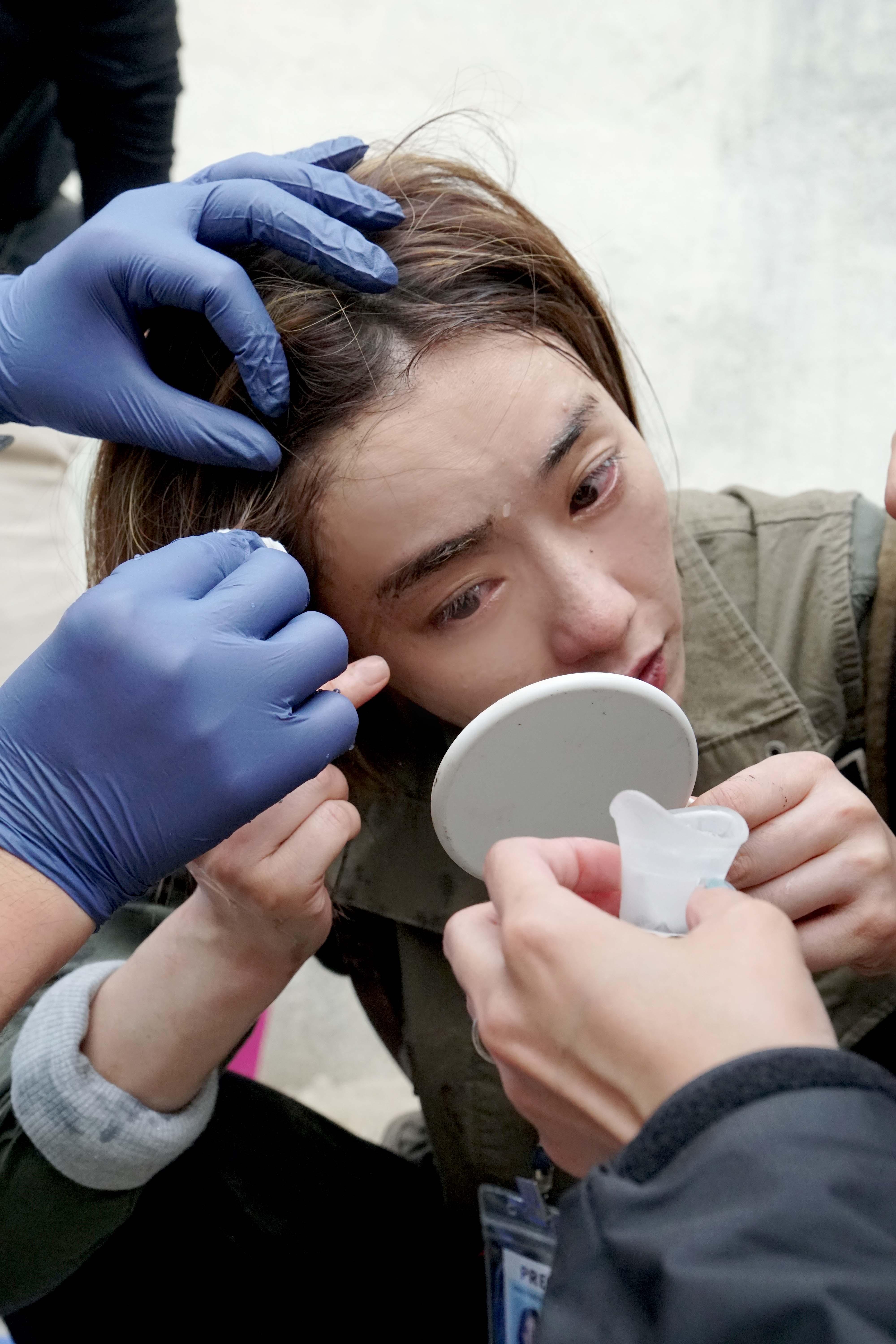 劉雅瑟拍爆破戲時,不慎被化學品弄致眼部受傷。