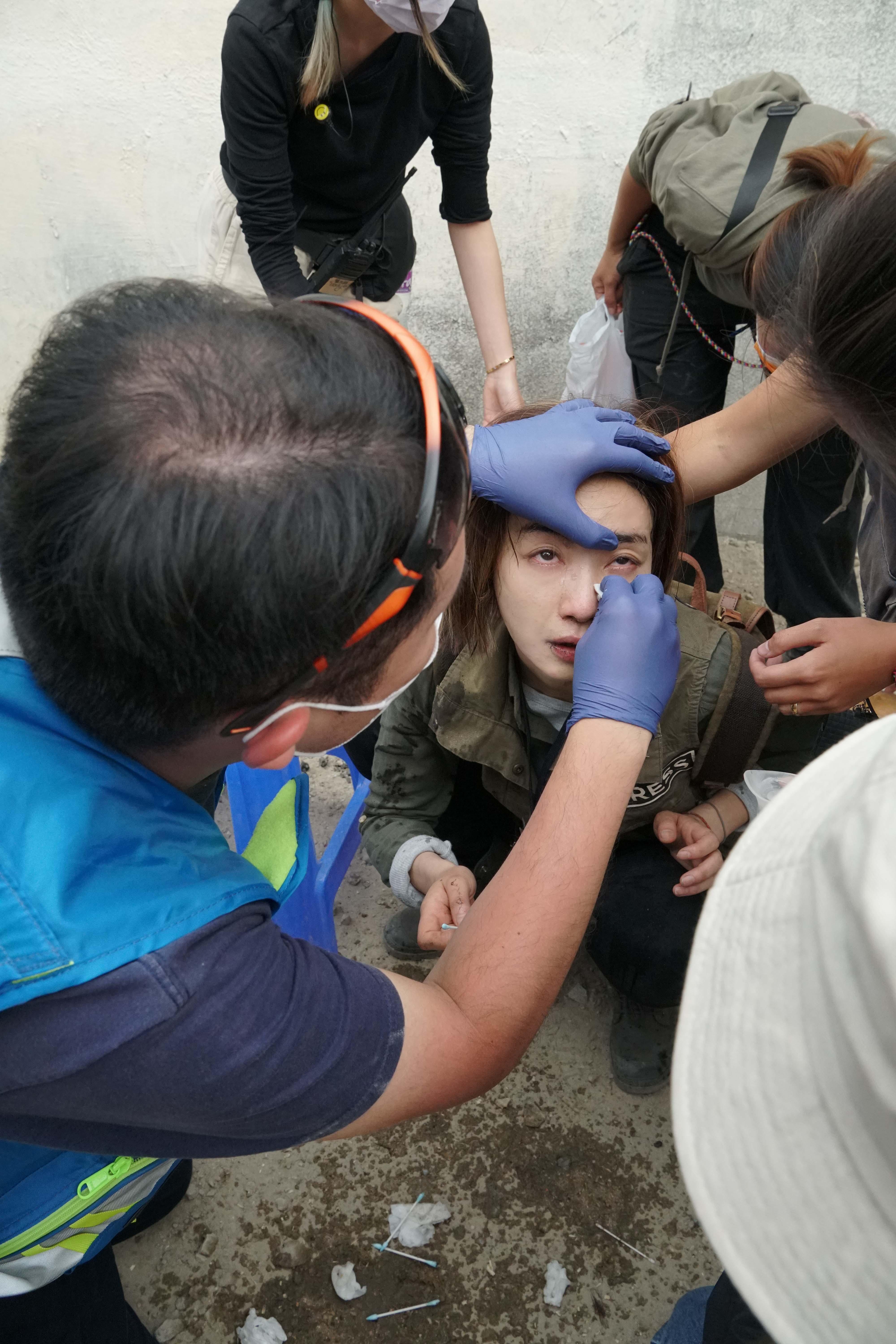 劉雅瑟拍爆破戲時,不慎被化學品弄致眼部受傷。