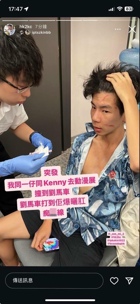 動漫節2024|「劉馬車」再被捕 涉會場襲擊16歲少年(IG@_see_mi_2)