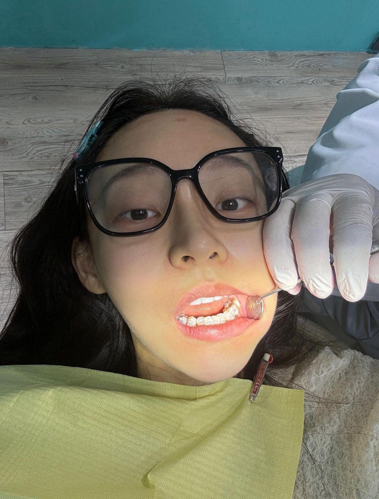 林襄放下女神包袱,貼出自己的箍牙照片。