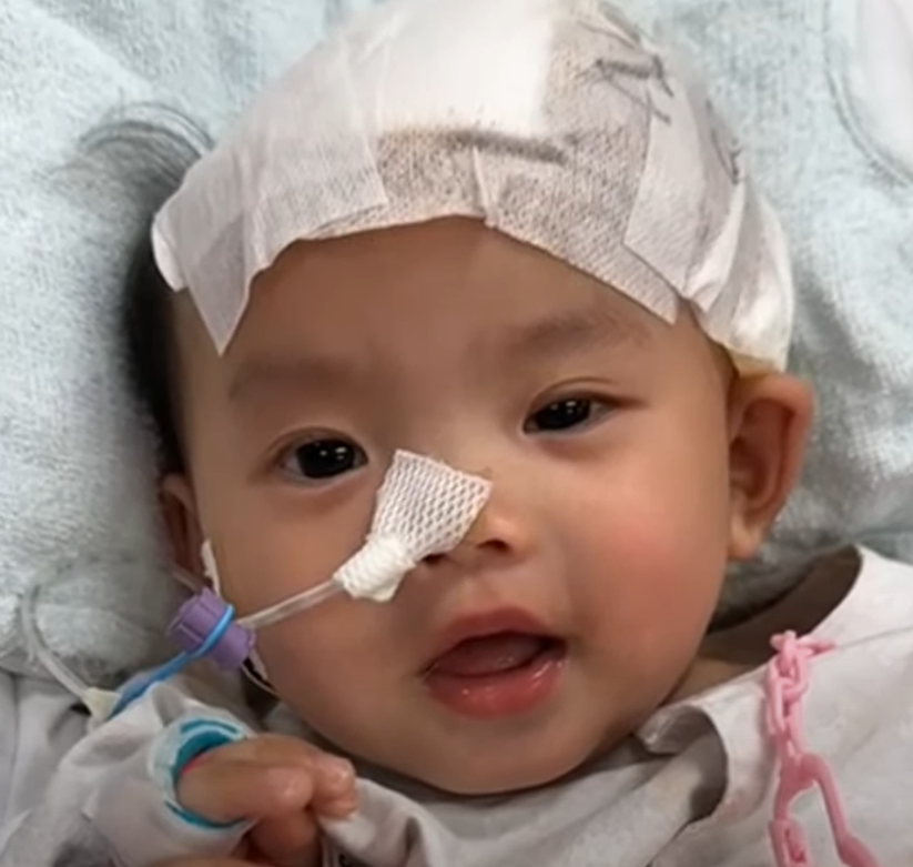 屯門一歲大女嬰小雪兒於今年1月在社區保母照顧期間懷疑遭虐待,導致昏迷及腦出血,需要緊急進行頭顱骨重置手術。(資料圖片/《東張西望》畫面)