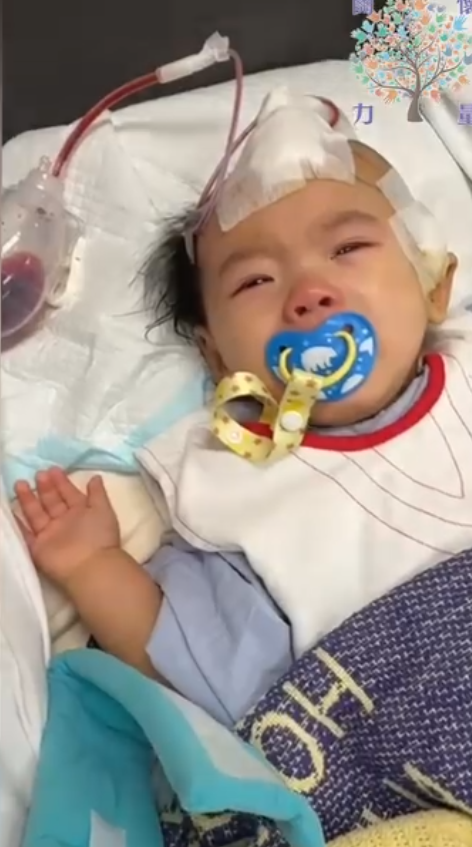 屯門一歲大女嬰小雪兒於今年1月在社區保母照顧期間懷疑遭虐待,導致昏迷及腦出血,需要緊急進行頭顱骨重置手術。(資料圖片)