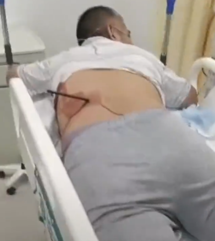 網上流傳片段顯示兩名男子分別在腰部和背部疑被弓箭射中,正在送院救治。