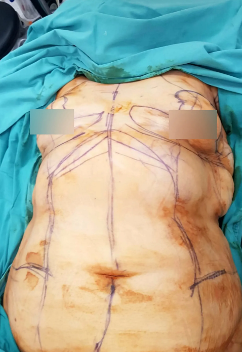 Sara手術前情況。(互聯網)