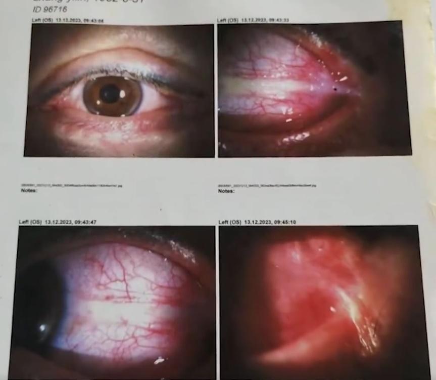 事主提出想去外省的大醫院進行手術治療,但院方以費用過高為由,堅持要她在本地接受治療。(微博)