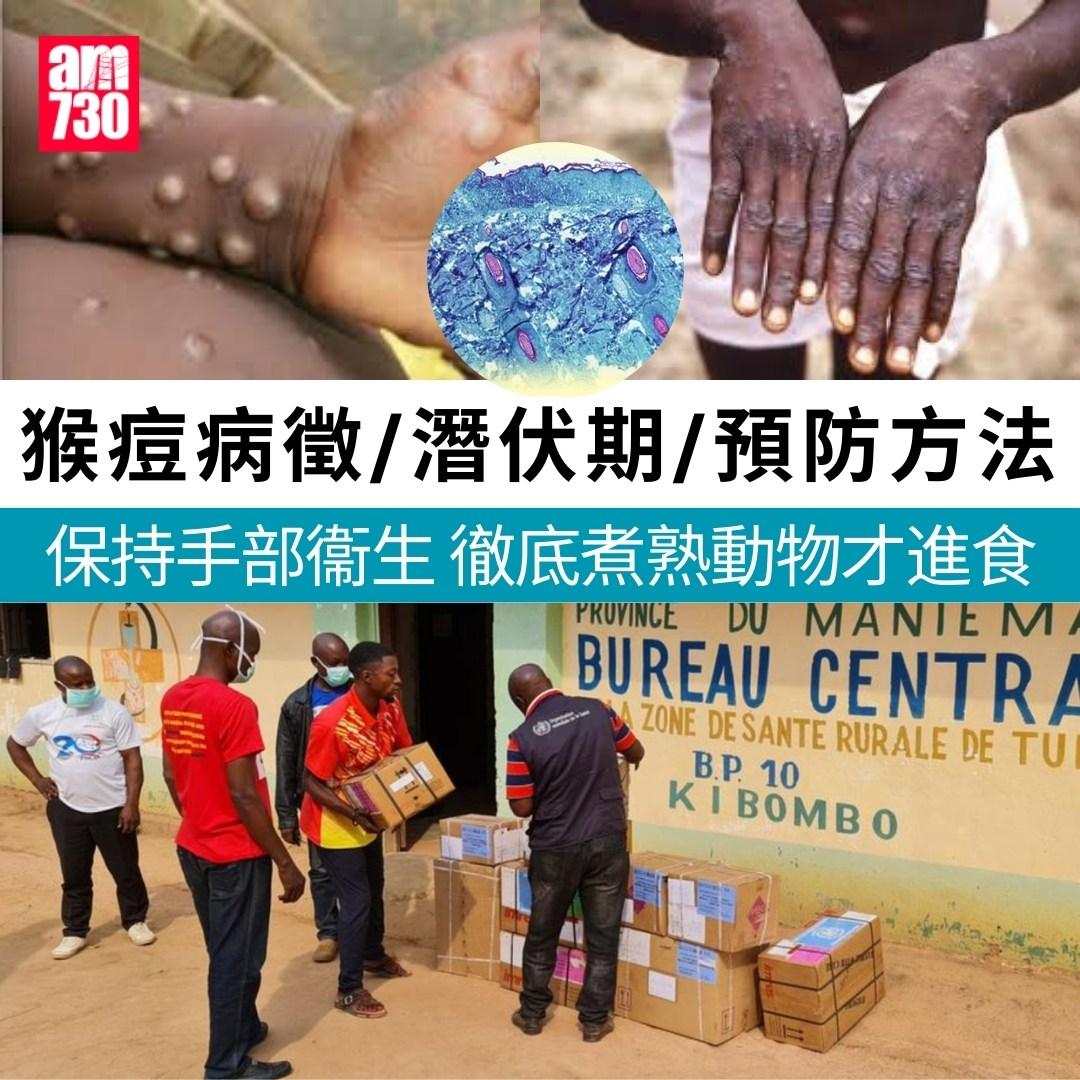 猴痘|病徵/潛伏期/預防方法(am730製圖)