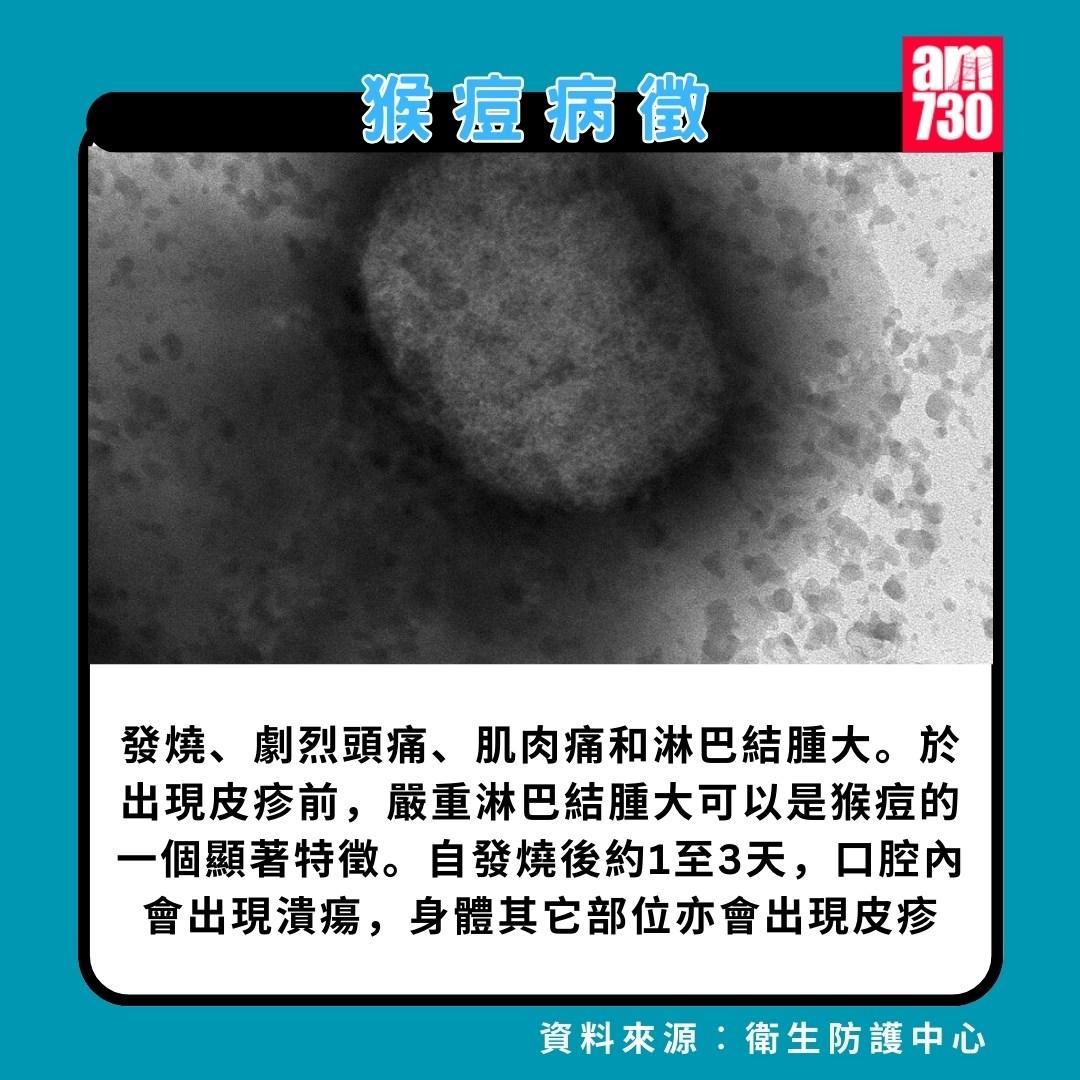猴痘|病徵(am730製圖)