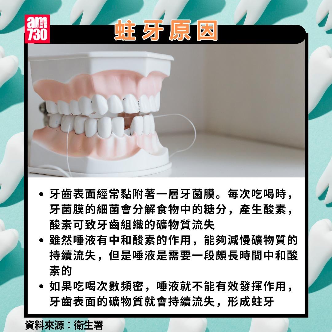 蛀牙點算?原因(am730製圖)