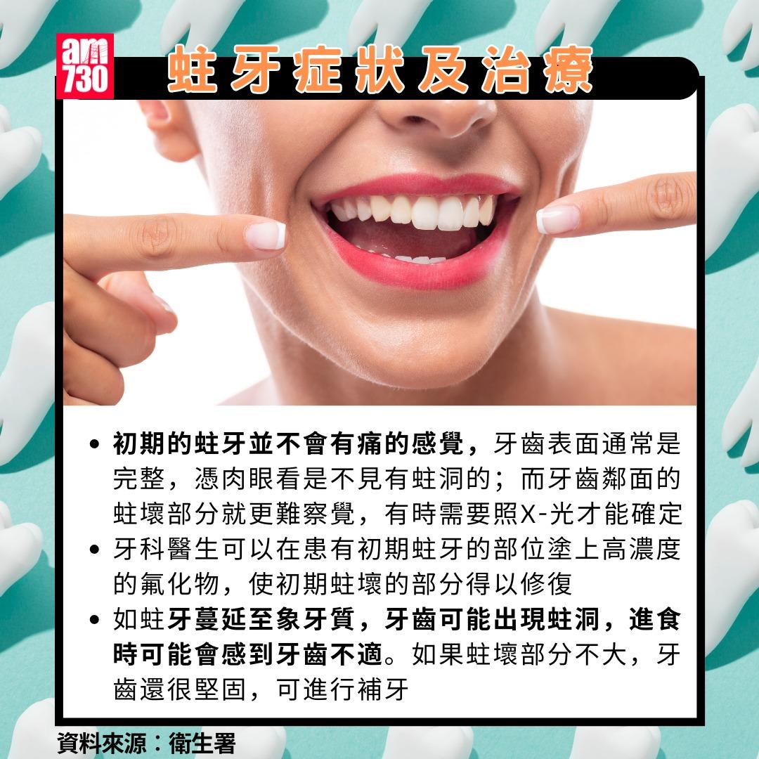 蛀牙點算?症狀及治療(am730製圖)
