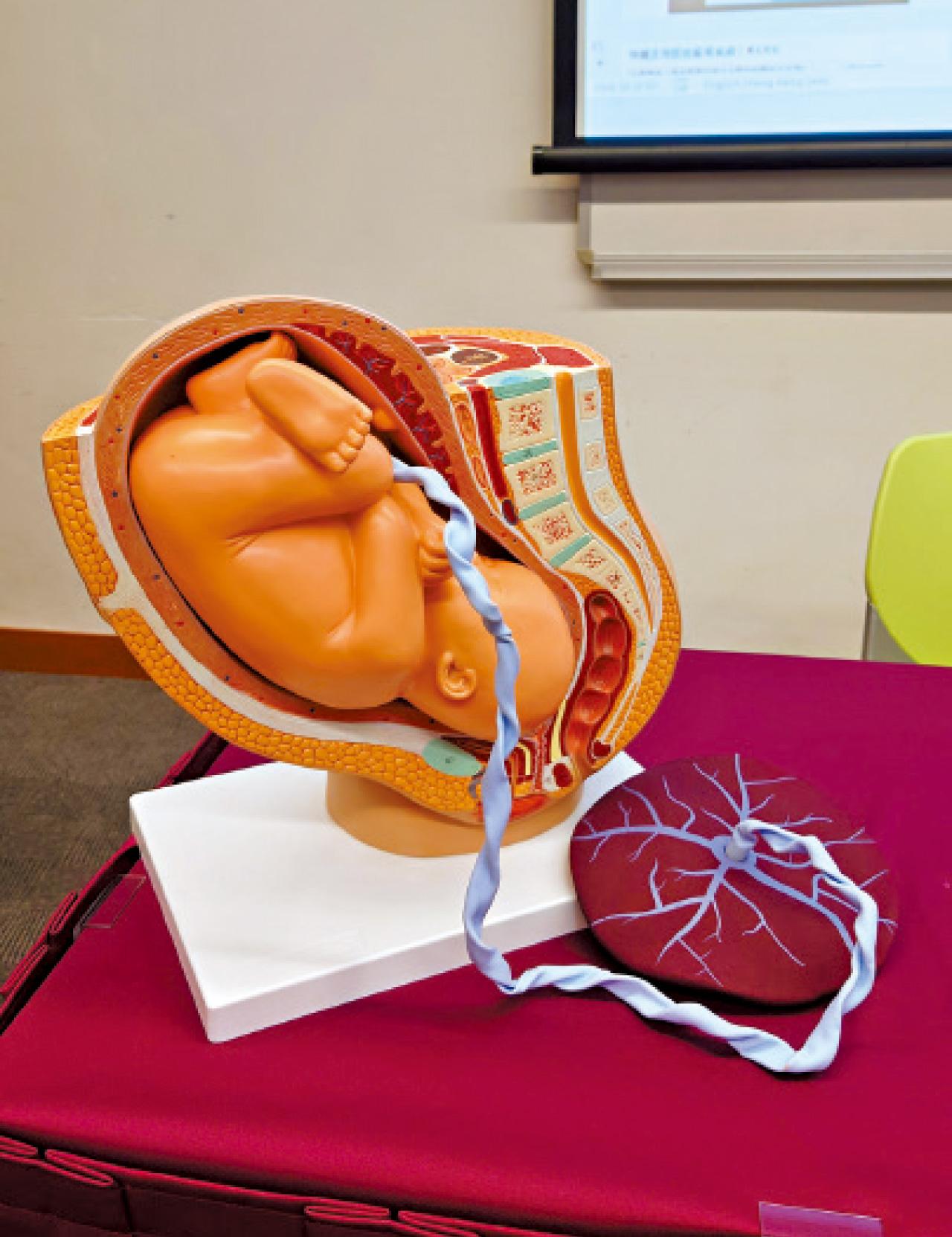 妊娠毒血症 胎盤