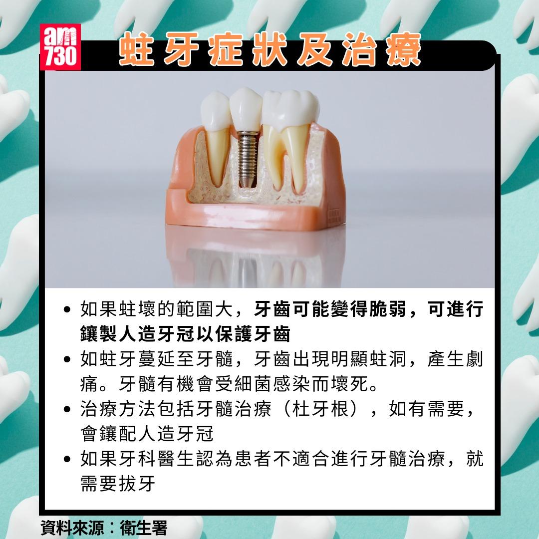 蛀牙點算?症狀及治療(am730製圖)