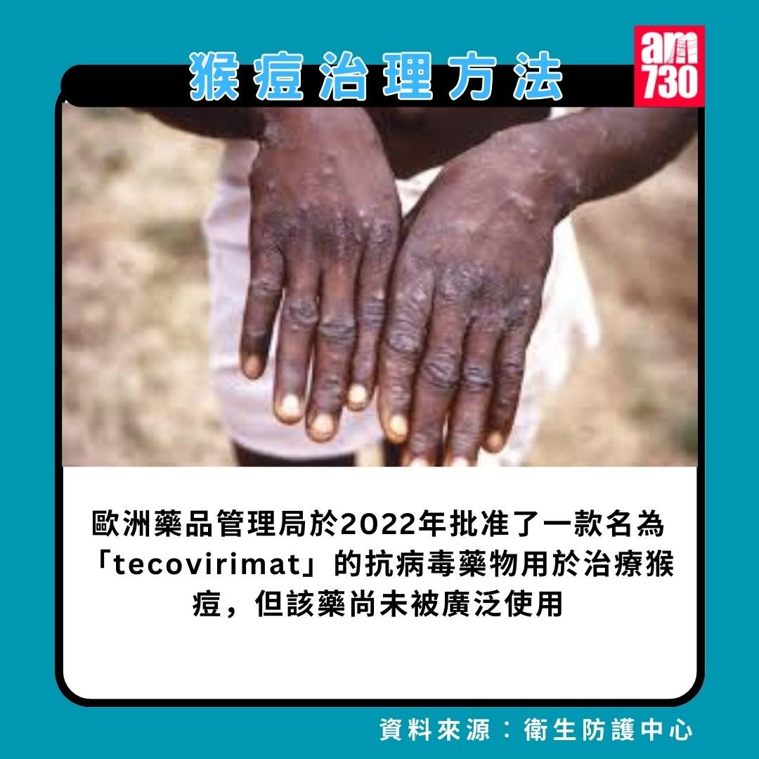猴痘|治理方法(am730製圖)