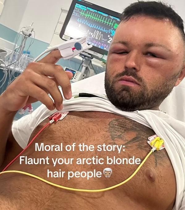 醫生指,Ryan對一種常見於染髮劑的化學物「苯二胺」(paraphenylenediamine)產生過敏,要留院進行13小時觀察。(網上圖片)