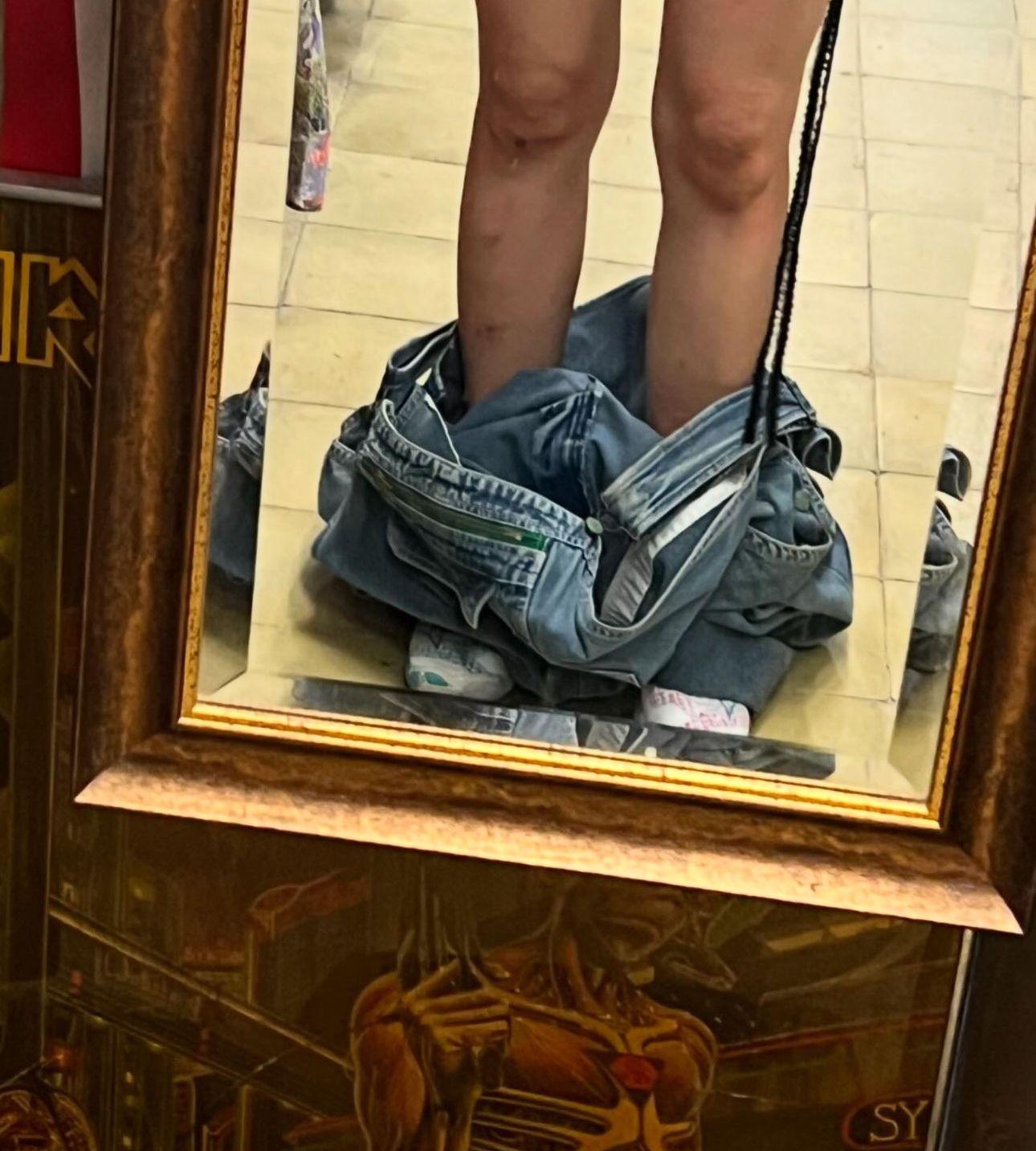 Angela在台灣拍攝時被蟲咬至滿腳傷痕。